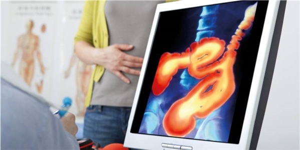 estudiocancercolon